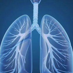 Artificial Intelligence may speed lung cancer detection