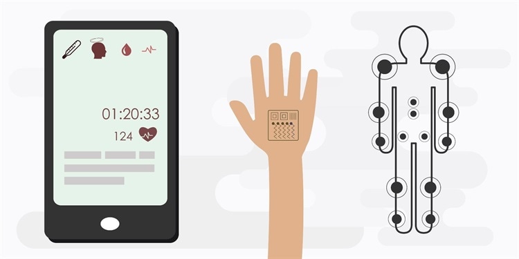 Trends in Flexible Wearable Sensors for Arrhythmia Diagnosis