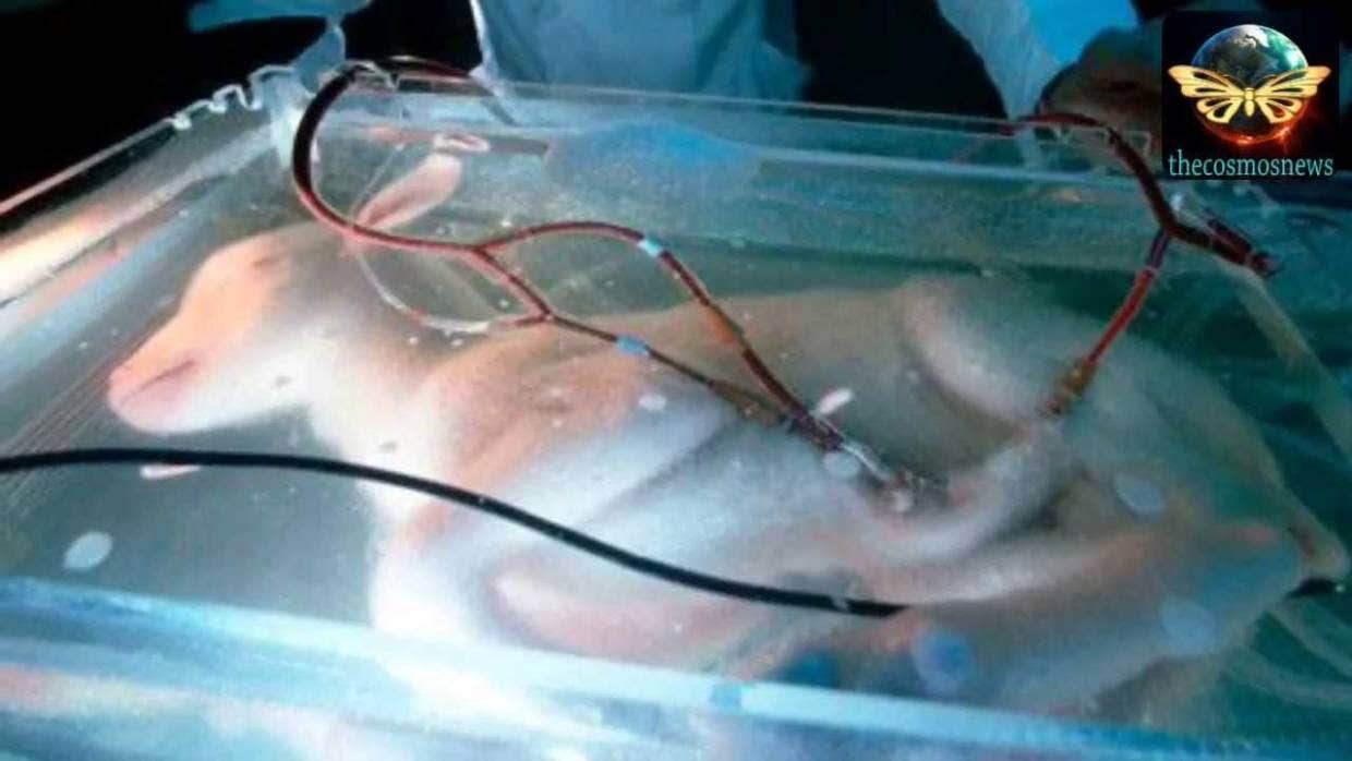 Synthetic wombs could help premature babies