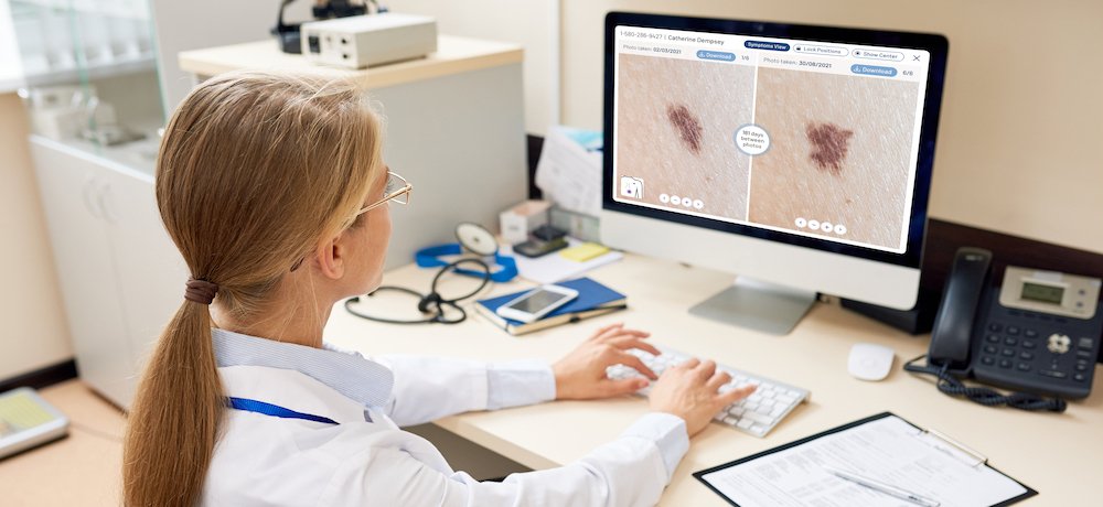 Miiskin opens technology to enable more dermatology research