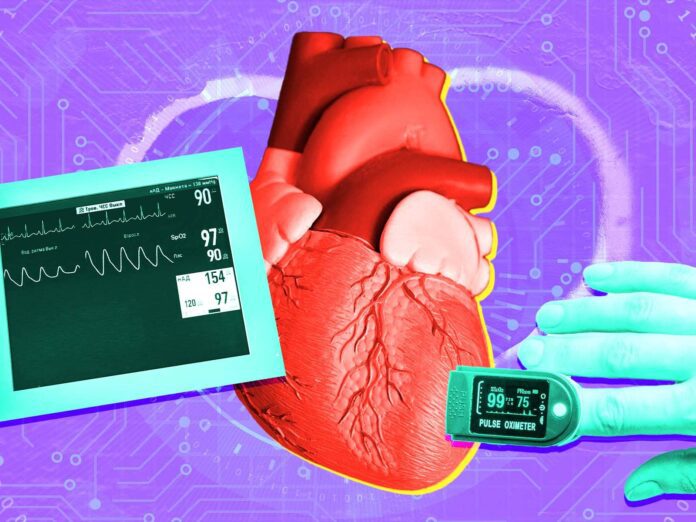 IoT Monitoring Devices & Early Detection of Heart Diseases